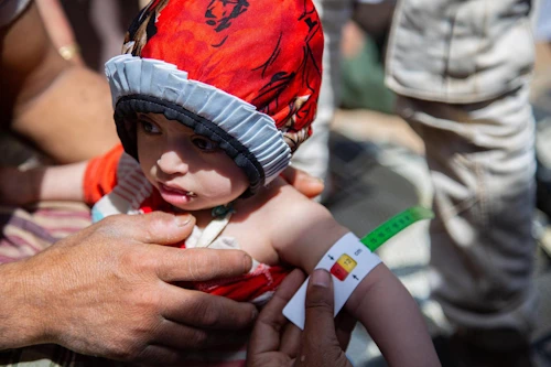 Ljósmynd: UNICEF